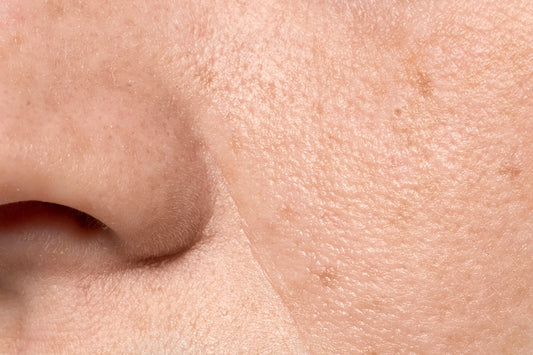 Peau déshydratée : 5 conseils efficaces pour une hydratation durable